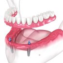드림탑치과의원 이미지