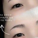 디프미