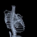 자세교정 필라테스 이미지