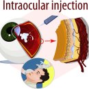 서울퍼시픽안과의원 이미지