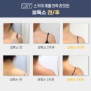 광진구 승모근보톡스 웨딩 전 신부 어깨관리 고민해결