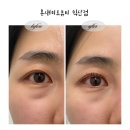 어양주공4단지아파트 | 익산 어양동 속눈썹펌 잘하는집 온새미로 뷰티 익산점