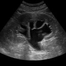 엔도소노 이미지