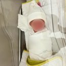 미래제일산부인과의원 | 수지미래산부인과 / 37주 6일 / 응급제왕 출산 후기