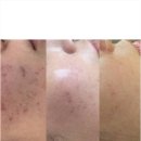 피아나뷰티랩
