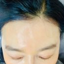 리앤플러스 | 광주 북구 각화동 내성 적은 국내산 저비용 보톡스 리앤톡 후기