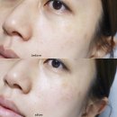 준메디케어 이미지