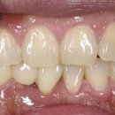 엠웍스 치과기공소 이미지