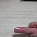 동아단골약국 | [동아제약_내돈내산]색소침착치료제 멜라토닝크림(전편)