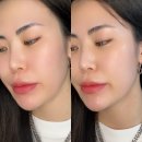 유앤미화장품 | [디아뮤 비타5X 피디알엔 세럼 + 콜라겐미스트 후기] 모공과 광채, 둘 다 잡는 30대화장품 리얼 후기!