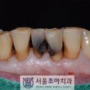 서울조아치과 이미지