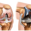 이재규 스포츠 재활 이미지