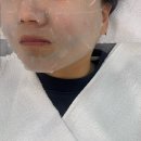 스킨올 | 청주 에스테틱 "올스킨" 여드름 관리 후기