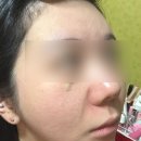 화잘먹세럼 퍼셀 픽셀바이옴 글로우 배리어 세럼 쓰고 화잘먹 피부 만든 후기