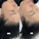 수정헤어라인 - 김해시 인제로169번길 10 | 수정헤어라인