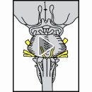 Pontine Level 이미지