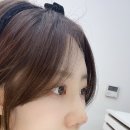 양성열성형외과 | ღ 코수술 당일차 ~ 7일차 후기 [양성열 성형외과]