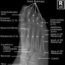 파트라슈 이미지