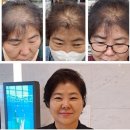 큐사랑 네이버블로그