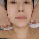 제이제이애드 | [직딩일기] 위례 윤곽관리 - 울쎄라 지속력 높이는 방법 / 유튜버 손민수하기/ 30대 얼굴관리