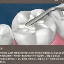 노원인플란트치과의원 이미지