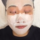 한성랩 | 모공·피부결 고민 끝! 대구 수성구 채채스킨랩 슈퍼젝션 체험후기👍🏻