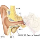 프라임보청기 이미지