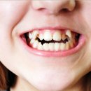 스마일디자인 이미지