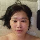 소솔에스테틱 | 화명동에스테틱 '소솔 에스테틱' 방문 후기 및 에스테틱 관리의 필요성