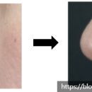 나인원의원 이미지