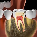 이치덴탈 이미지