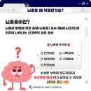 오늘 10월 29일(수) &#39;뇌졸중의 날 &#34;골든타임은 &#39;무조건 빨리&#39; 이미지