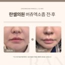 청담하나피부과의원 이미지