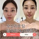 5212 | 부산리프팅 달리핀 에스테틱 윤곽관리 받고온 후기