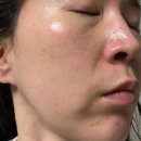 바이오메드 | 플라센타 태반크림 후기 유바이오메드 재생크림 솔직 사용기