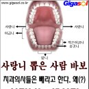 오른쪽 위 어금니가 아파서~~ 이미지