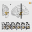 명문온누리약국 | 기억력 영양제 고르는 법 (feat. 치매 자가진단과 예방법)