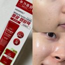 (주)메디필 | 올리브영 마스크팩 추천, 메디필 레드락토 콜라겐 랩핑 마스크 솔직후기