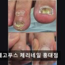 디에고푸스 체리네일 홍대점