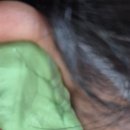 엘림독일보청기 이미지