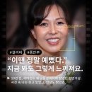 더리프트의원 | [중안부 리프팅 재수술] 다움성형외과 김대현 원장이 설계한 걸리버리프트, 진짜 후기 공개!