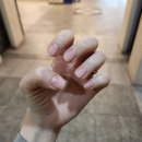 사직스카이 | [사직 스카이피부과 + 손더네일] 이마 도돌도돌 치료하고 네일까지 정리 후기