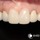 샤인치과기공소 이미지