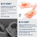 영주치과기공소 | 틀니 벗고 임플란트로 반짝반짝~무치악에서 유치악으로 &#34;바루다치과&#34;와 함께라면 완벽!가능해요!