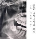한번에치과의원 | 신촌 잎사귀치과 사랑니 2개 한 번에 뽑은 후기 _ 불친절하다고? NO!