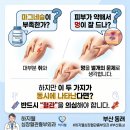 하지웰심장혈관흉부외과의원 | 종아리 쥐와 멍이 반복된다면 저는 혈관 초음파를 권합니다