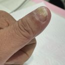 황금목욕탕 | 대구 수성구 문제성 발톱 &#39;르엘라 푸스케어 수성황금점&#39;에서 무좀 손톱 스케일링 솔직 후기