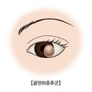 유전질환 골덴하 증후군(Goldenhar syndrome)이란? 이미지