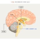 &#34;노년의 적 파킨슨병…한국인 위험요인 1위는 운동부족&#34; 이미지