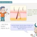 땀 많이 나는 이유, 땀냄새가 심할 때 (다한증 ) 이미지